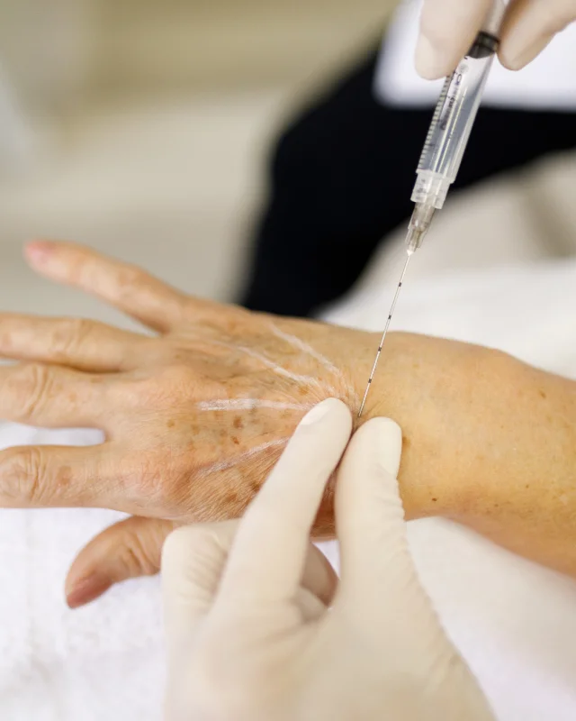 bioestimulador para flacidez corporal