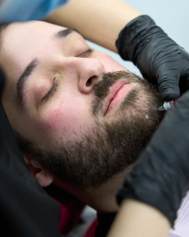 contorno mandibular