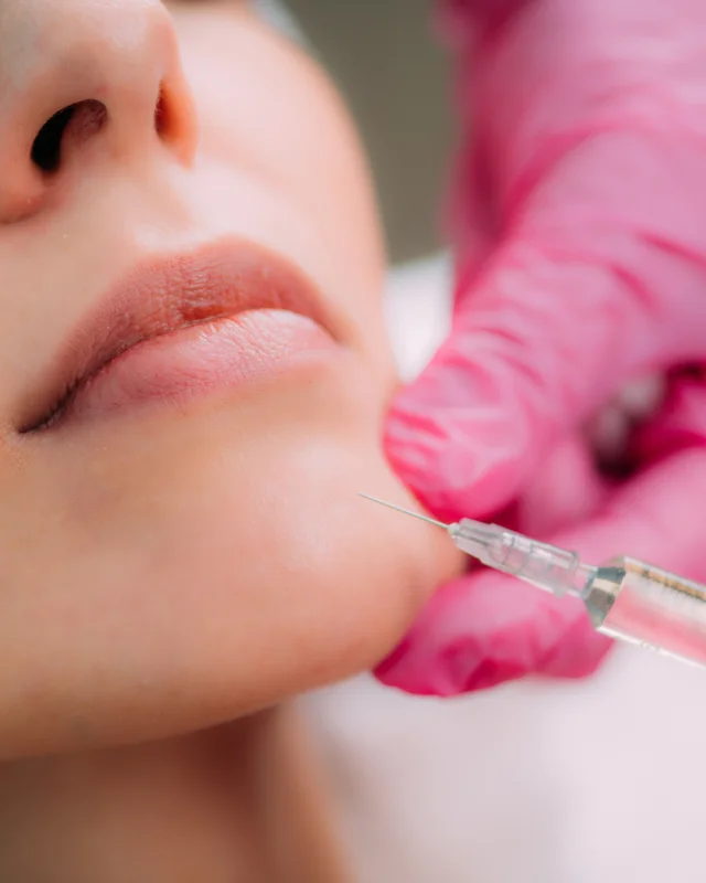 contorno mandibular com ácido hialurônico