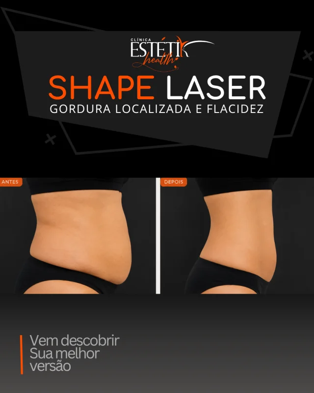 endolaser