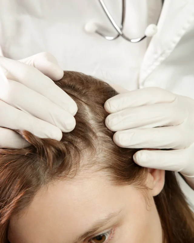 intradermoterapia capilar