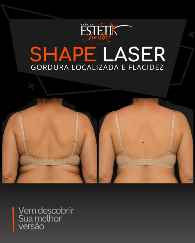 lipo sem corte