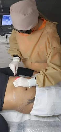 Precisão estratégica para resultados impecáveis