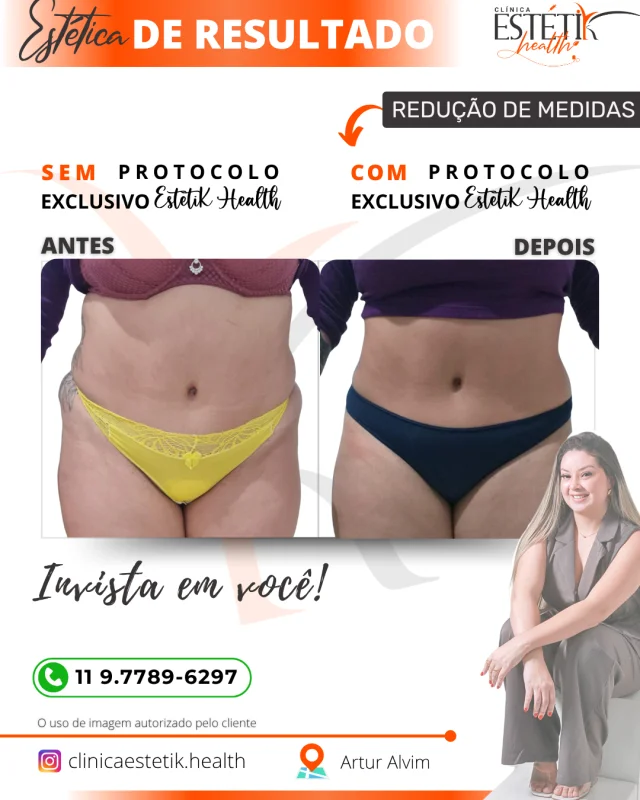redução de medidas