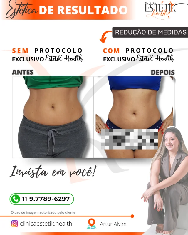 redução de medidas
