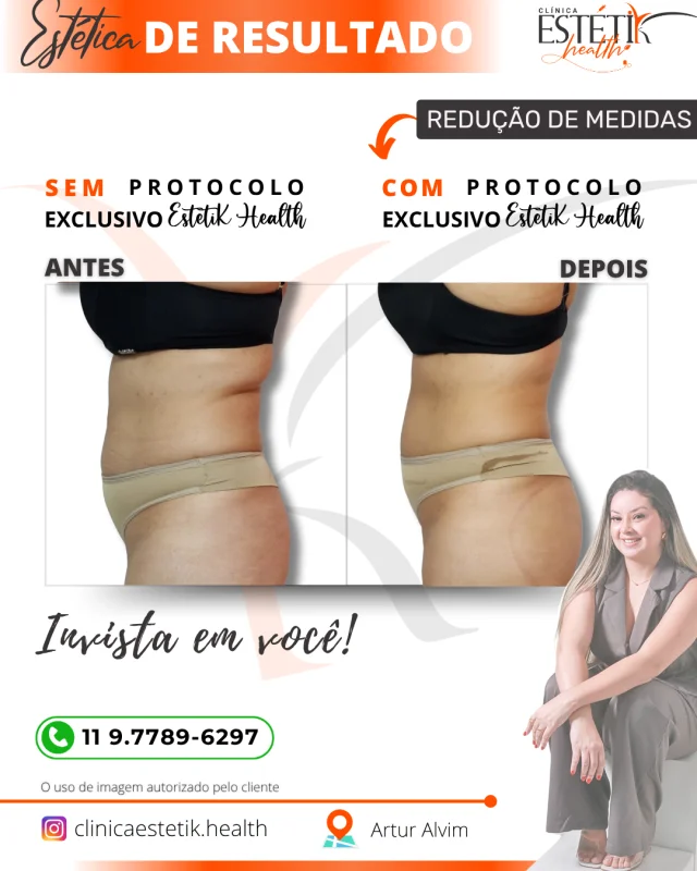 redução de medidas