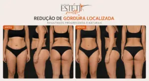 Redução de Medidas