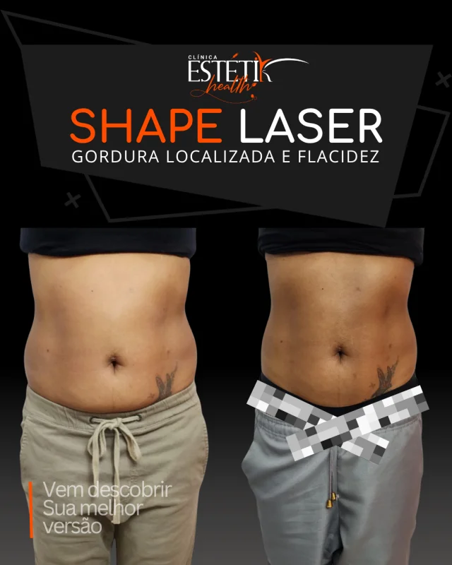 tratamento com endolaser