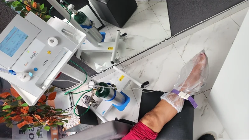 tratamento com ozônio para coluna