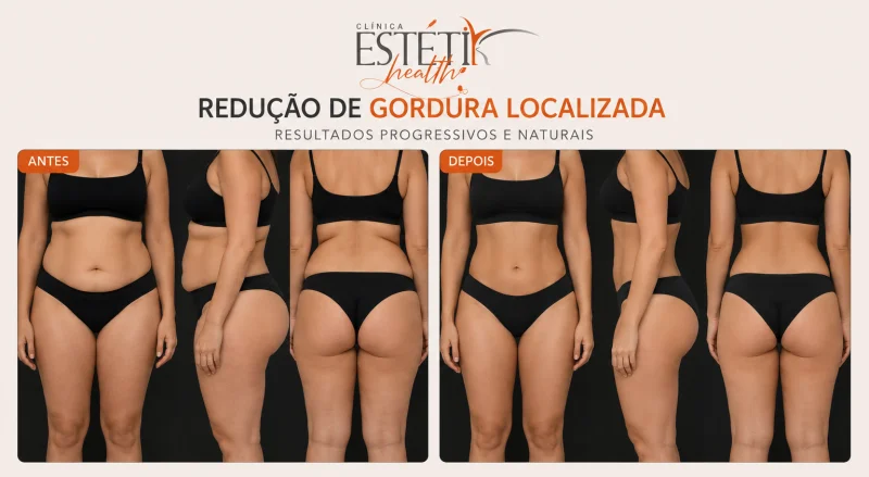 tratamento corporal para redução de medidas