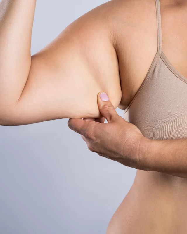 tratamento de melasma