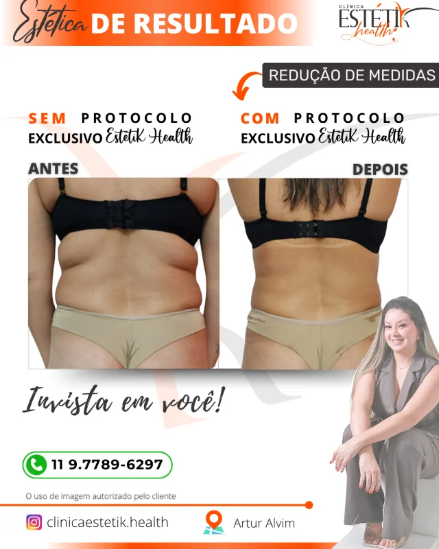 tratamento para quebra de gordura